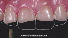 全新(xīn)口腔修复系统——瓷睿刻